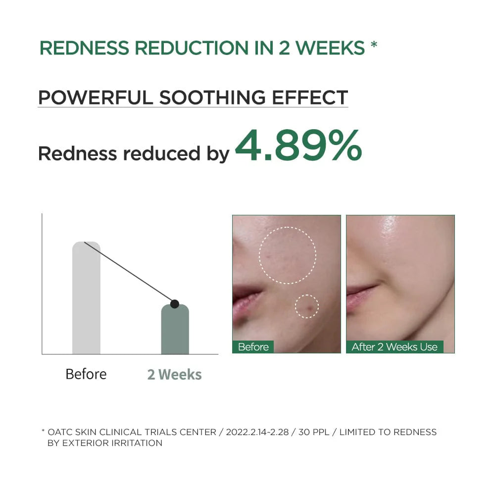 ANUA Ser Soothing Ampoule 80% Heartleaf Koan Beauty