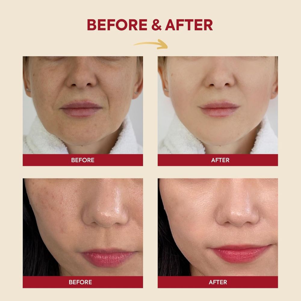 KSecret Seoul 1988 Essence: Snail Mucin 97% + Rice Koan Beauty