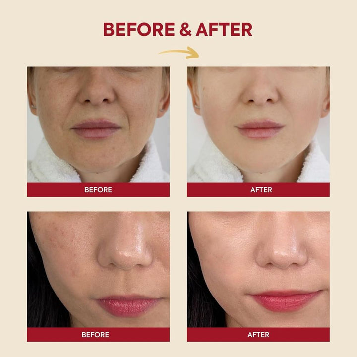 KSecret Seoul 1988 Essence: Snail Mucin 97% + Rice Koan Beauty