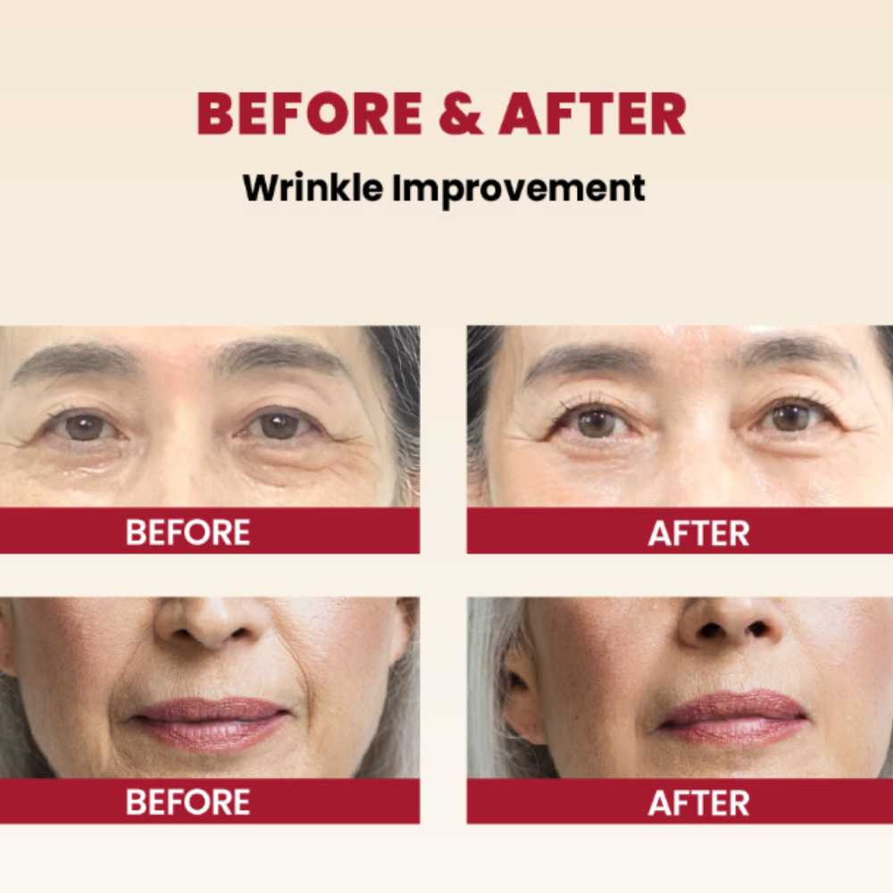 KSecret Seoul 1988 Cream: Retinal Liposome 1% + Fermented Rice Koan Beauty