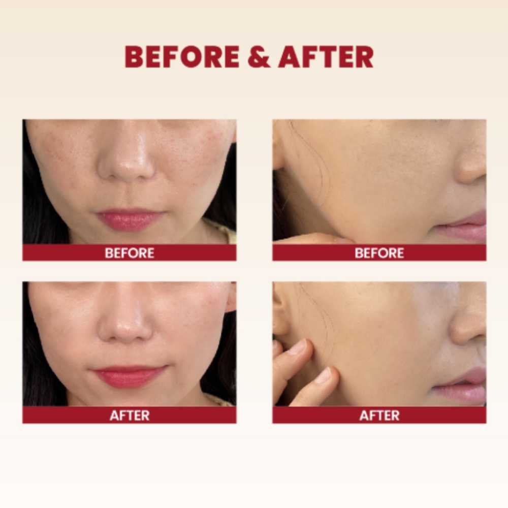 KSecret Seoul 1988 Cream: Snail Mucin 93% + Rice Koan Beauty