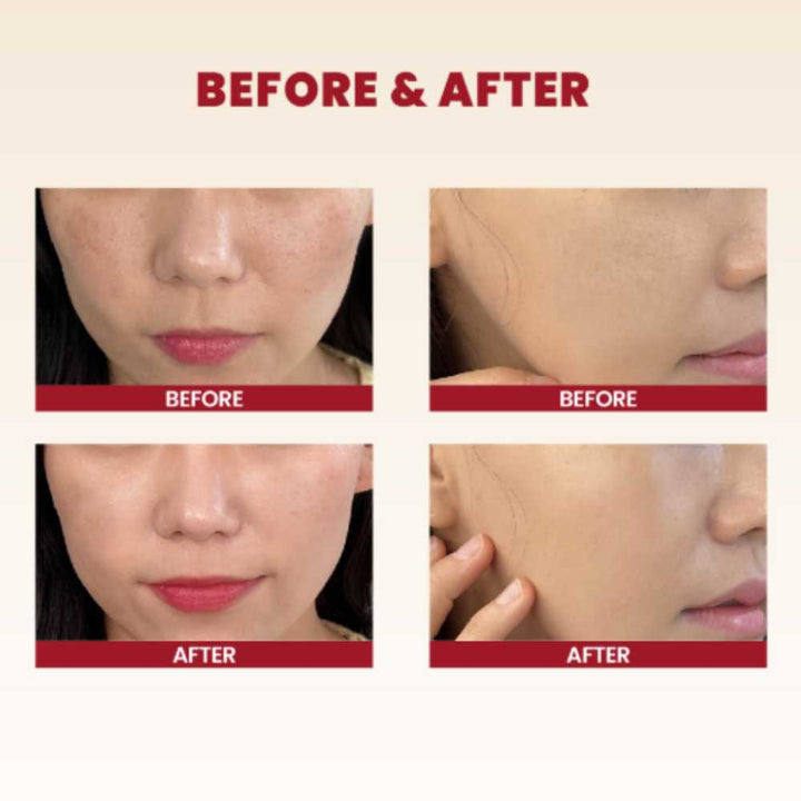 KSecret Seoul 1988 Cream: Snail Mucin 93% + Rice Koan Beauty
