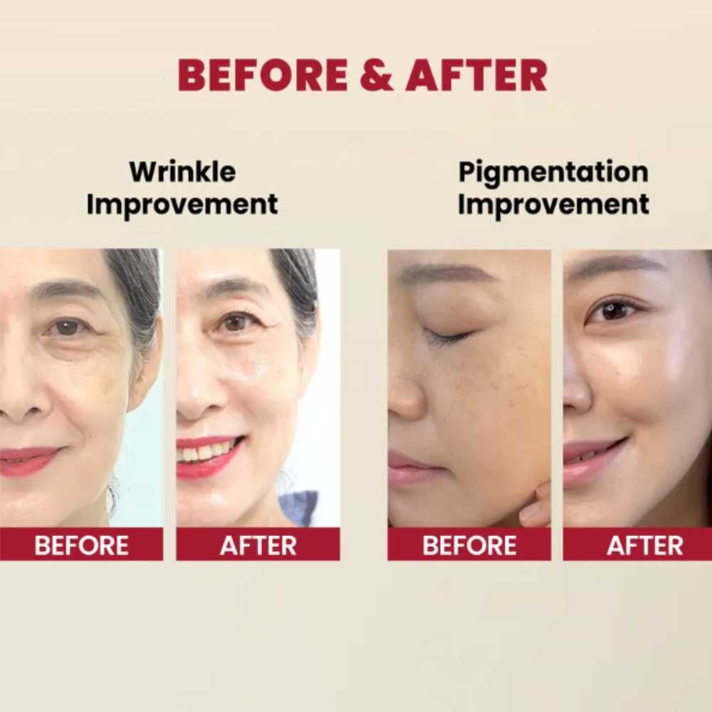 KSecret Seoul 1988 Serum: Retinal Liposome 2% + Black Ginseng Koan Beauty