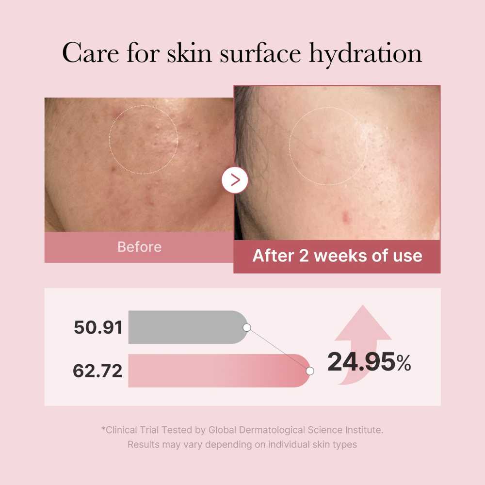 Medicube PDRN Pink Glutathione Serum Mist 100ml Koan Beauty