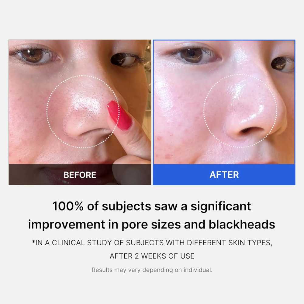 Medicube Zero Pore Pad 2.0 (70 pads) Koan Beauty
