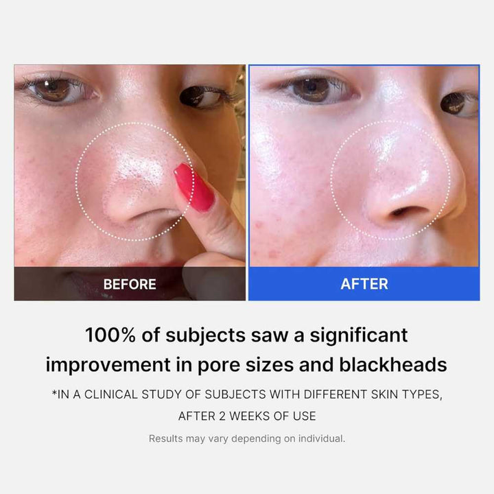 Medicube Zero Pore Pad 2.0 (70 pads) Koan Beauty