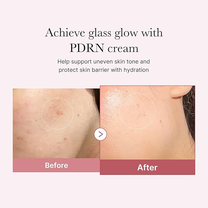 Medicube PDRN Pink Hyaluronic Moisturizing Cream Koan Beauty